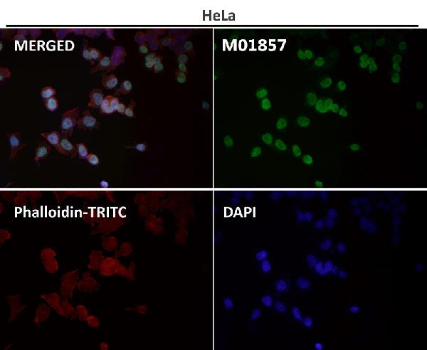 1 - Anti-beta III Tubulin TUBB3 Rabbit Monoclonal Antibody ABO14219