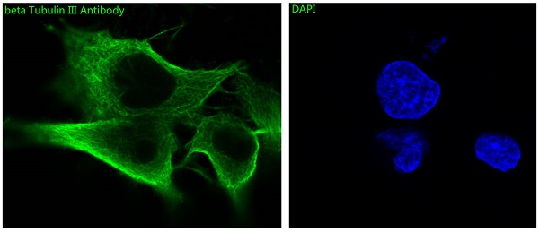 3 - Anti-beta III Tubulin TUBB3 Rabbit Monoclonal Antibody ABO14219