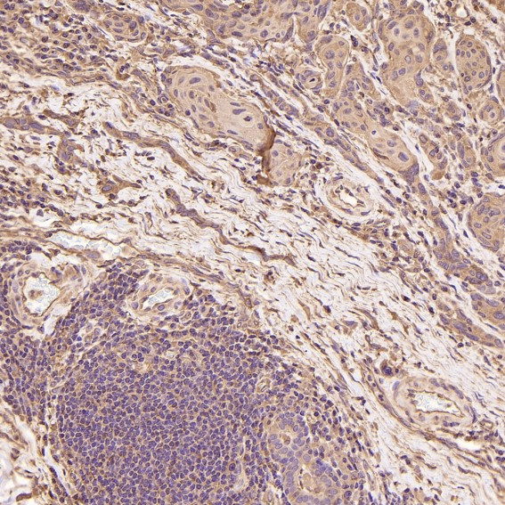 2 - Anti-beta III Tubulin TUBB3 Rabbit Monoclonal Antibody ABO14219