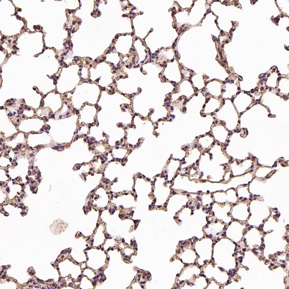 2 - Anti-beta III Tubulin TUBB3 Rabbit Monoclonal Antibody ABO14219