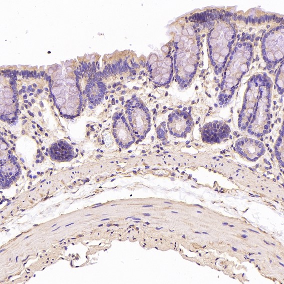 2 - Anti-beta III Tubulin TUBB3 Rabbit Monoclonal Antibody ABO14219