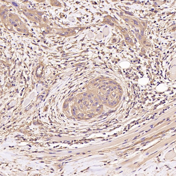 2 - Anti-beta III Tubulin TUBB3 Rabbit Monoclonal Antibody ABO14219