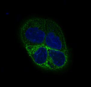 3 - Anti-beta III Tubulin TUBB3 Rabbit Monoclonal Antibody ABO14220