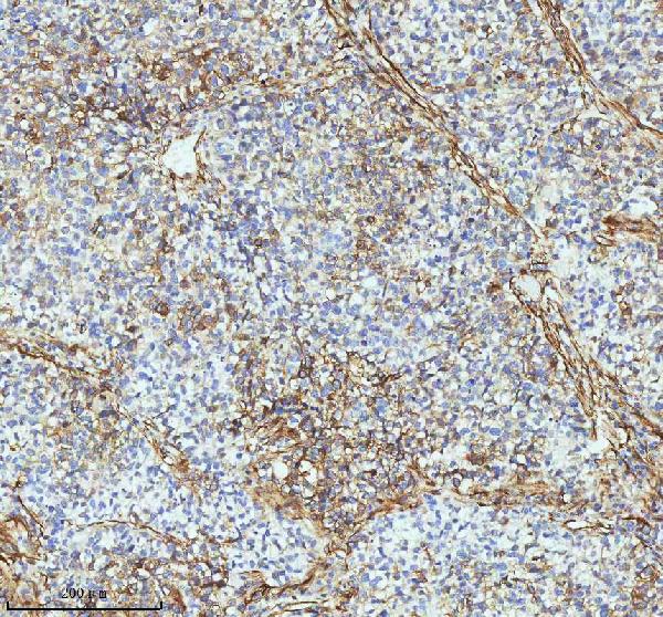 2 - Anti-beta III Tubulin TUBB3 Rabbit Monoclonal Antibody ABO14220