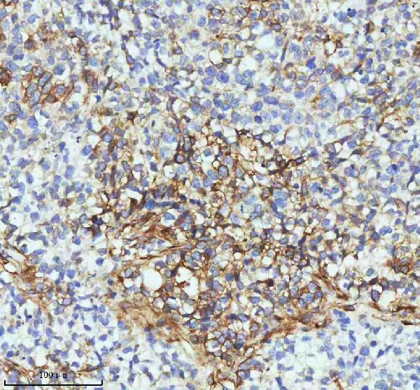 2 - Anti-beta III Tubulin TUBB3 Rabbit Monoclonal Antibody ABO14220