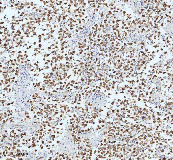 2 - Anti-beta III Tubulin TUBB3 Rabbit Monoclonal Antibody ABO14220