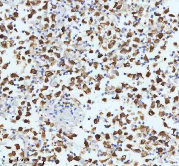 2 - Anti-beta III Tubulin TUBB3 Rabbit Monoclonal Antibody ABO14220