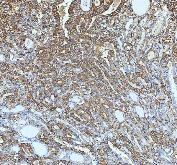 2 - Anti-beta III Tubulin TUBB3 Rabbit Monoclonal Antibody ABO14220