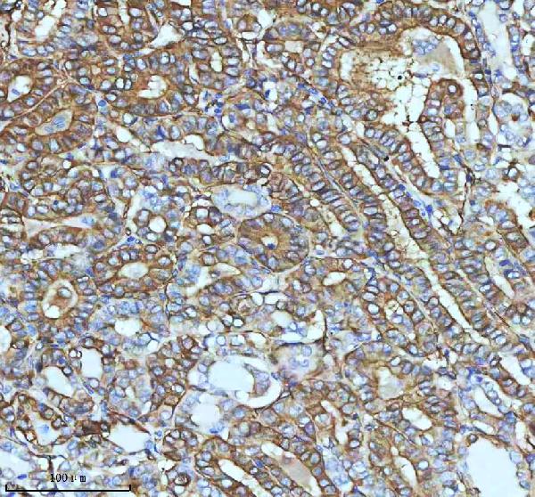 2 - Anti-beta III Tubulin TUBB3 Rabbit Monoclonal Antibody ABO14220