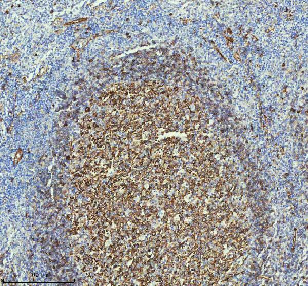 2 - Anti-beta III Tubulin TUBB3 Rabbit Monoclonal Antibody ABO14220