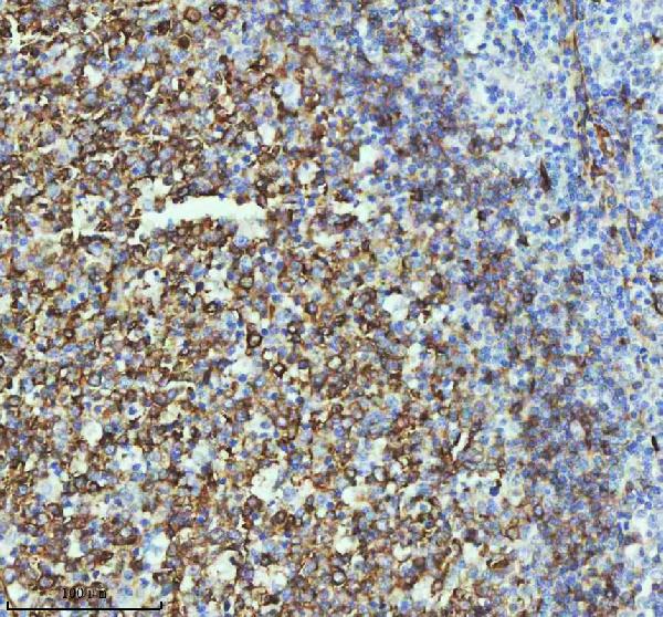 2 - Anti-beta III Tubulin TUBB3 Rabbit Monoclonal Antibody ABO14220