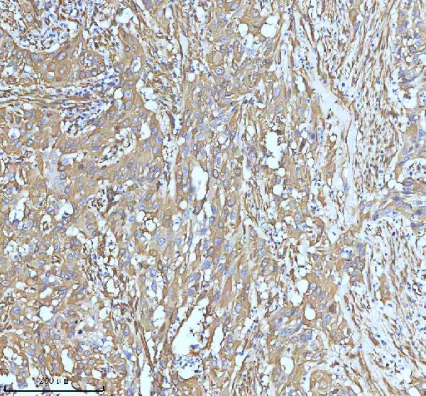 2 - Anti-beta III Tubulin TUBB3 Rabbit Monoclonal Antibody ABO14220