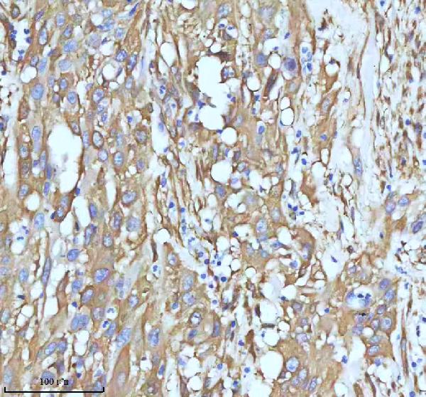 2 - Anti-beta III Tubulin TUBB3 Rabbit Monoclonal Antibody ABO14220