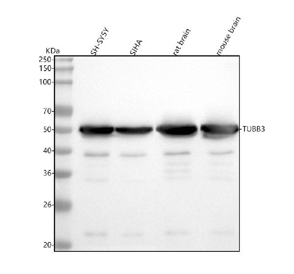 1 - Anti-beta III Tubulin TUBB3 Rabbit Monoclonal Antibody ABO14220