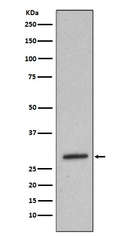 1 - Anti-Heme Oxygenase 1 HMOX1 Rabbit Monoclonal Antibody ABO14222