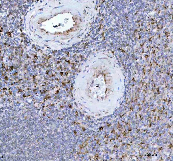 2 - Anti-Heme Oxygenase 1 HMOX1 Rabbit Monoclonal Antibody ABO14222