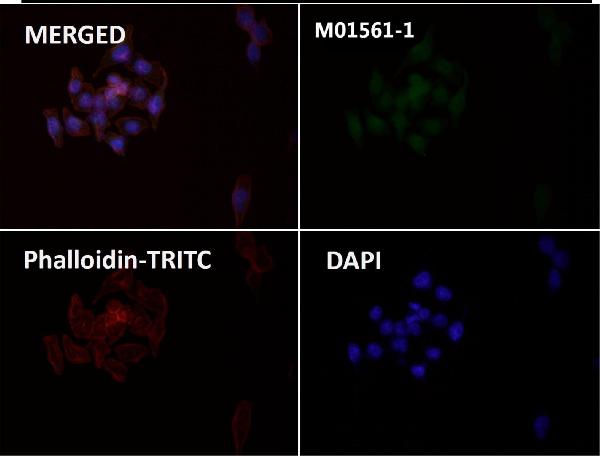 1 - Anti-Integrin alpha V ITGAV Rabbit Monoclonal Antibody ABO14223