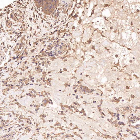 2 - Anti-Integrin alpha V ITGAV Rabbit Monoclonal Antibody ABO14223