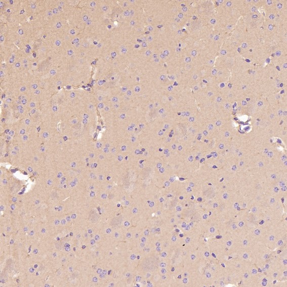 2 - Anti-Integrin alpha V ITGAV Rabbit Monoclonal Antibody ABO14223