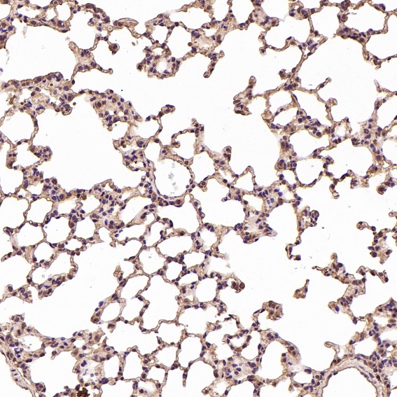 2 - Anti-Integrin alpha V ITGAV Rabbit Monoclonal Antibody ABO14223