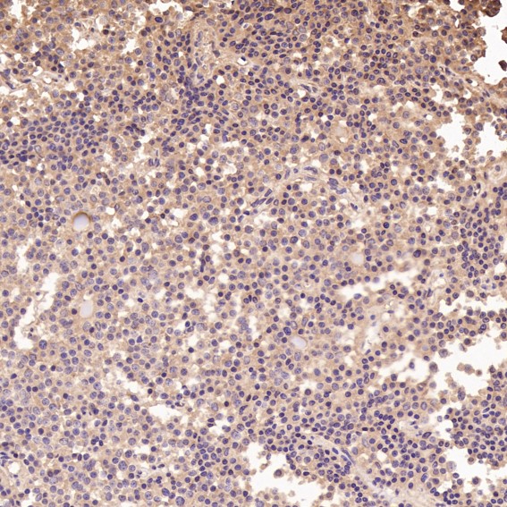 2 - Anti-Integrin alpha V ITGAV Rabbit Monoclonal Antibody ABO14223