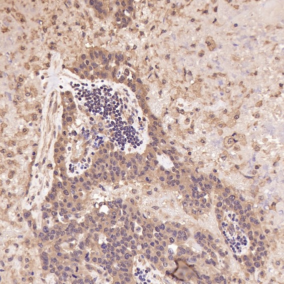 2 - Anti-Integrin alpha V ITGAV Rabbit Monoclonal Antibody ABO14223