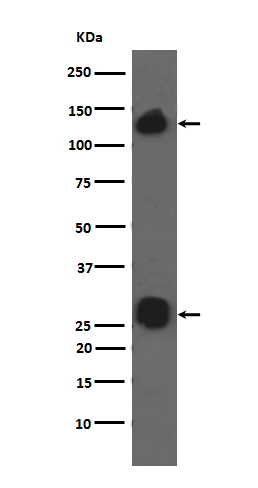 1 - Anti-Integrin alpha V ITGAV Rabbit Monoclonal Antibody ABO14223