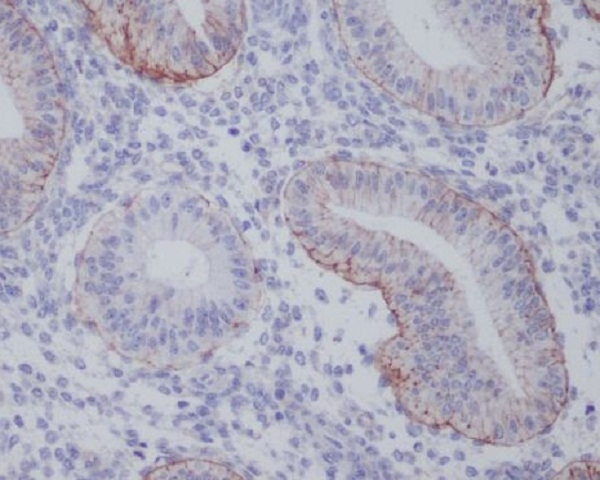 2 - Anti-Integrin alpha 6 ITGA6 Rabbit Monoclonal Antibody ABO14224