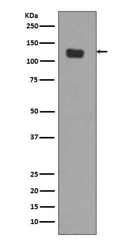 1 - Anti-Integrin alpha 6 ITGA6 Rabbit Monoclonal Antibody ABO14224