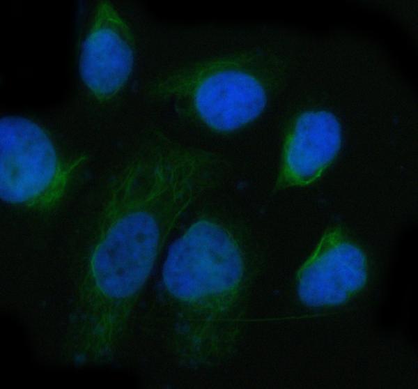 3 - Anti-Integrin alpha 6 ITGA6 Rabbit Monoclonal Antibody ABO14224