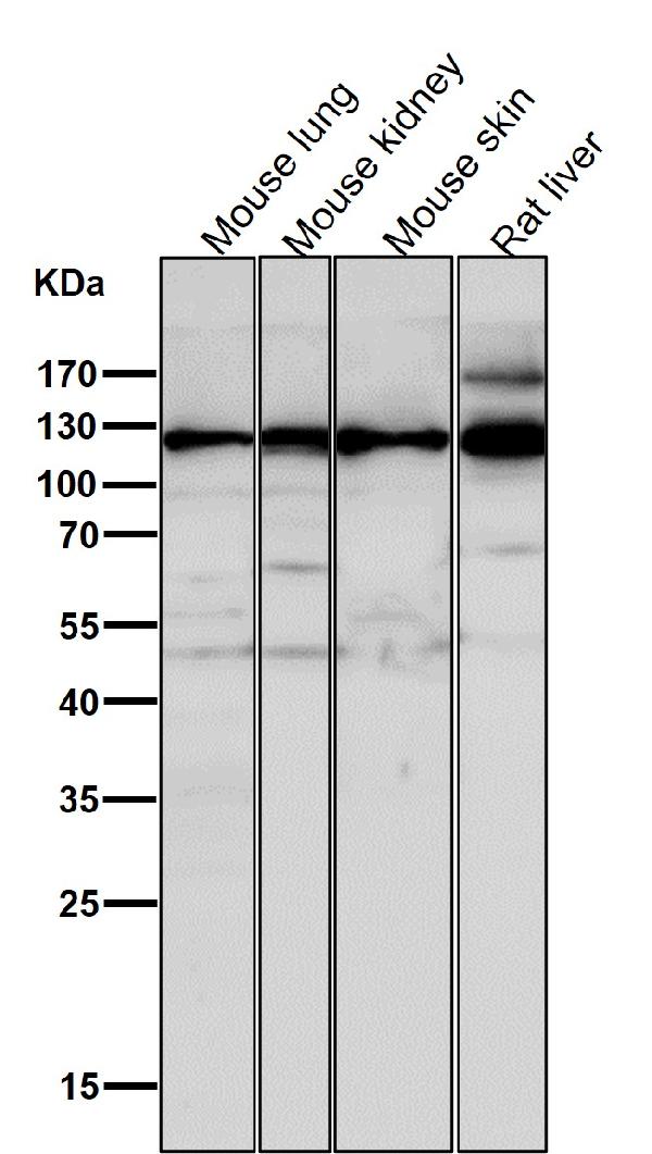 1 - Anti-Integrin alpha 6 ITGA6 Rabbit Monoclonal Antibody ABO14224