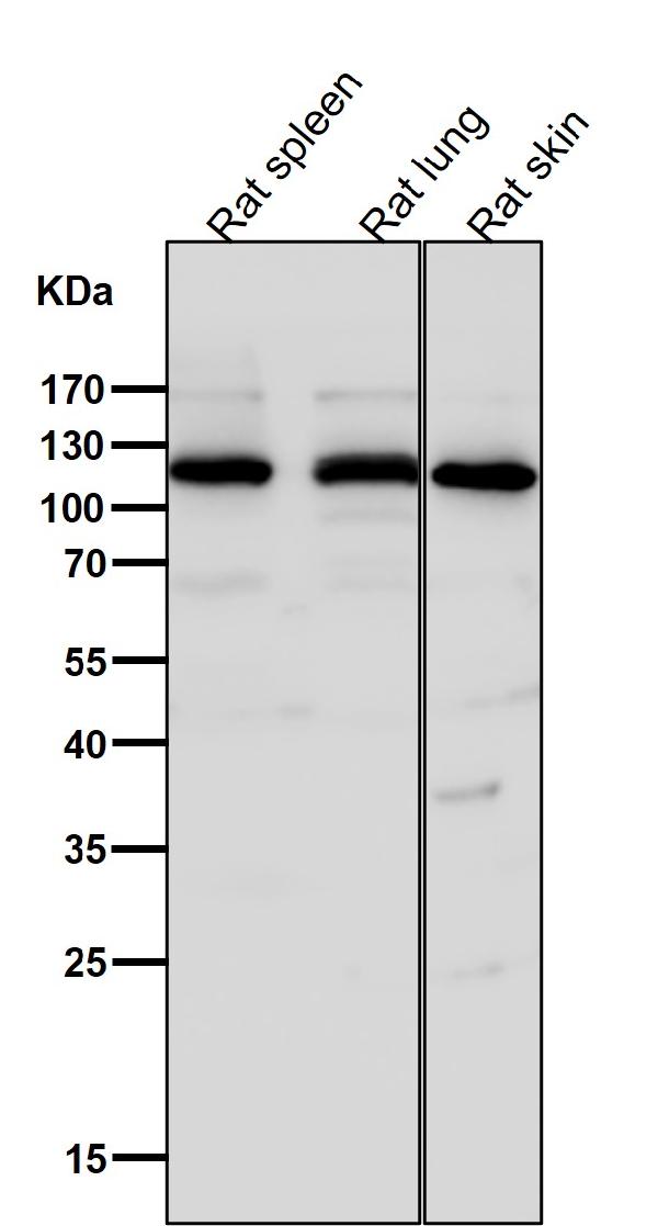 1 - Anti-Integrin alpha 6 ITGA6 Rabbit Monoclonal Antibody ABO14224