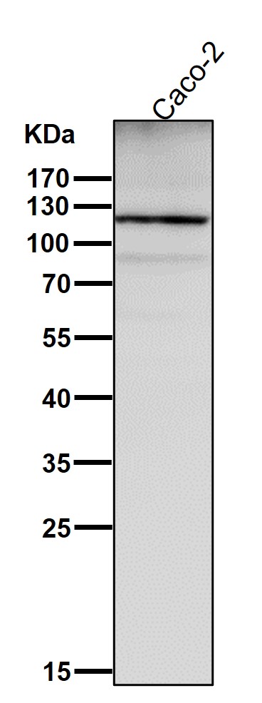 1 - Anti-Integrin alpha 6 ITGA6 Rabbit Monoclonal Antibody ABO14224