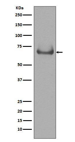 1 - Anti-Lamin B Receptor LBR Rabbit Monoclonal Antibody ABO14225