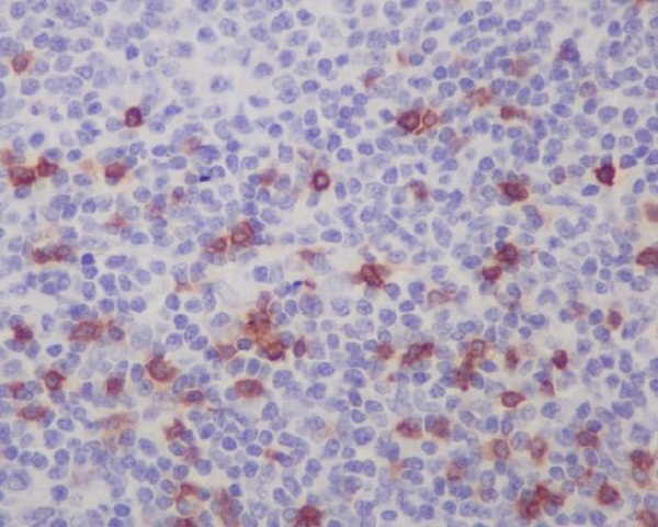 2 - Anti-Integrin alpha E ITGAE Rabbit Monoclonal Antibody ABO14226