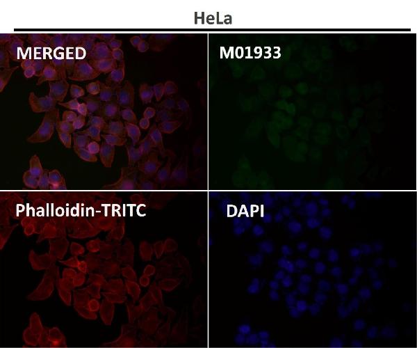 1 - Anti-Integrin alpha 2 ITGA2 Rabbit Monoclonal Antibody ABO14227