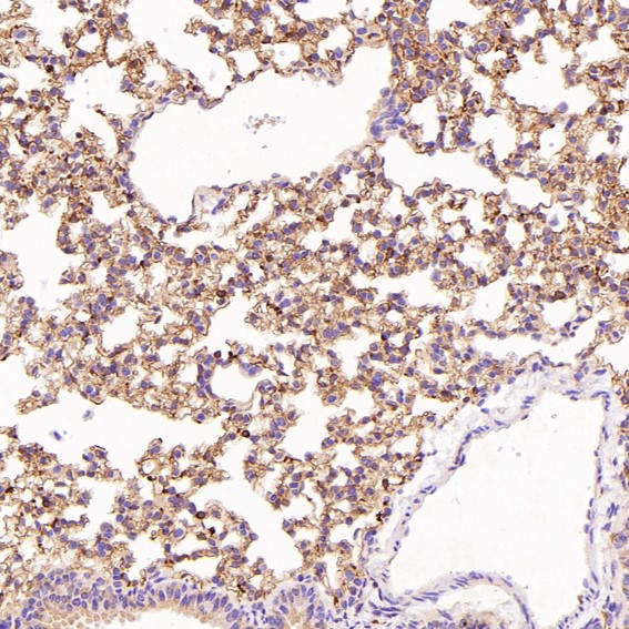 2 - Anti-Integrin alpha 2 ITGA2 Rabbit Monoclonal Antibody ABO14227