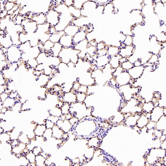 2 - Anti-Integrin alpha 2 ITGA2 Rabbit Monoclonal Antibody ABO14227