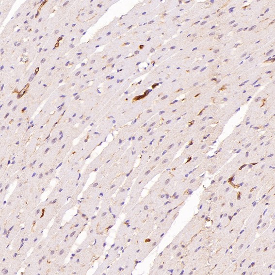 2 - Anti-Integrin alpha 2 ITGA2 Rabbit Monoclonal Antibody ABO14227