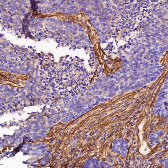 2 - Anti-Integrin alpha 2 ITGA2 Rabbit Monoclonal Antibody ABO14227