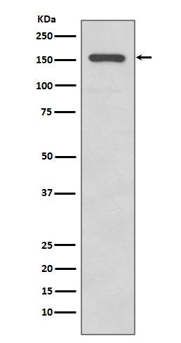1 - Anti-Integrin alpha 2 ITGA2 Rabbit Monoclonal Antibody ABO14227
