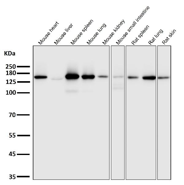 1 - Anti-Integrin alpha 2 ITGA2 Rabbit Monoclonal Antibody ABO14227