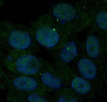 3 - Anti-Insulin Receptor INSR Rabbit Monoclonal Antibody ABO14228
