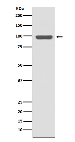 1 - Anti-Insulin Receptor INSR Rabbit Monoclonal Antibody ABO14228