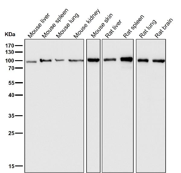 1 - Anti-Insulin Receptor INSR Rabbit Monoclonal Antibody ABO14228