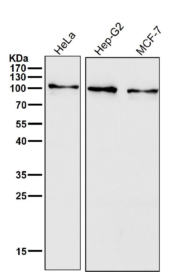 1 - Anti-Insulin Receptor INSR Rabbit Monoclonal Antibody ABO14228
