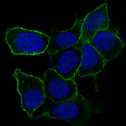 3 - Anti-Integrin alpha 5 ITGA5 Rabbit Monoclonal Antibody ABO14229