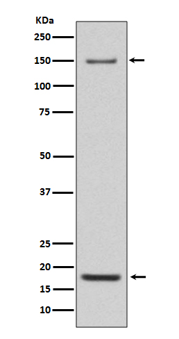 1 - Anti-Integrin alpha 5 ITGA5 Rabbit Monoclonal Antibody ABO14229