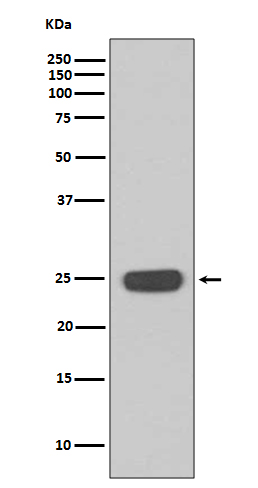 1 - Anti-Interferon gamma IFNG Rabbit Monoclonal Antibody ABO14231