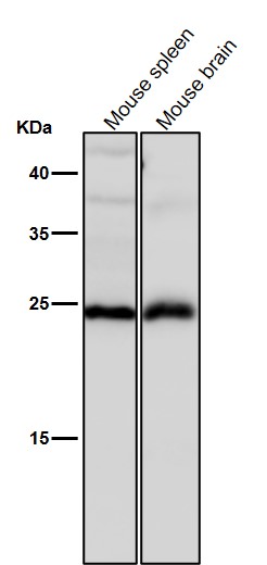 1 - Anti-Interferon gamma IFNG Rabbit Monoclonal Antibody ABO14231